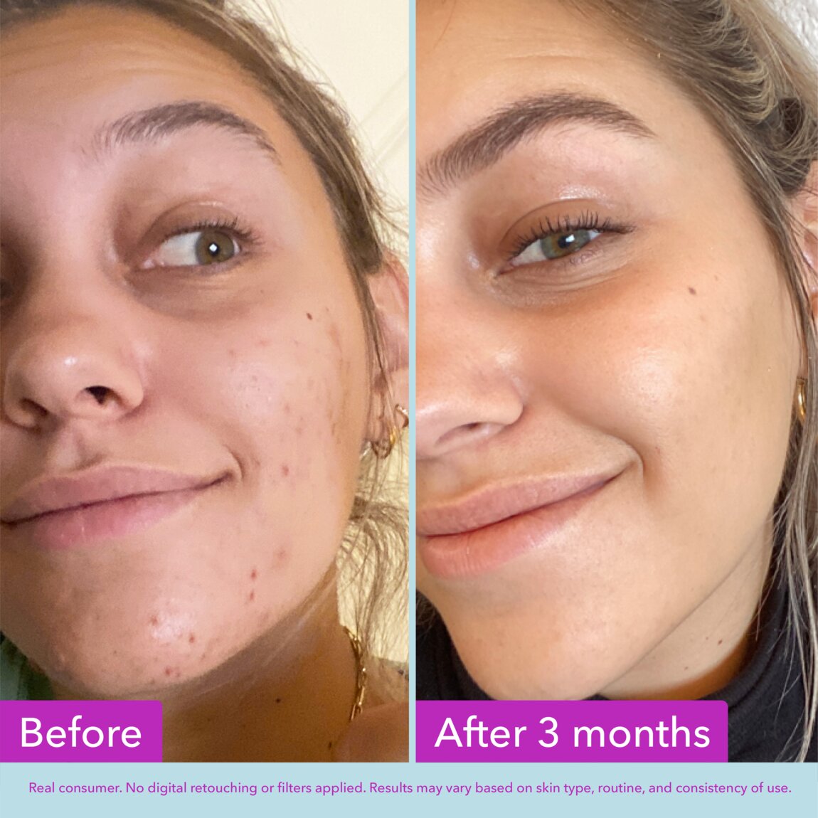niacinamide-brightening-toner-p2 zb_p.jpg