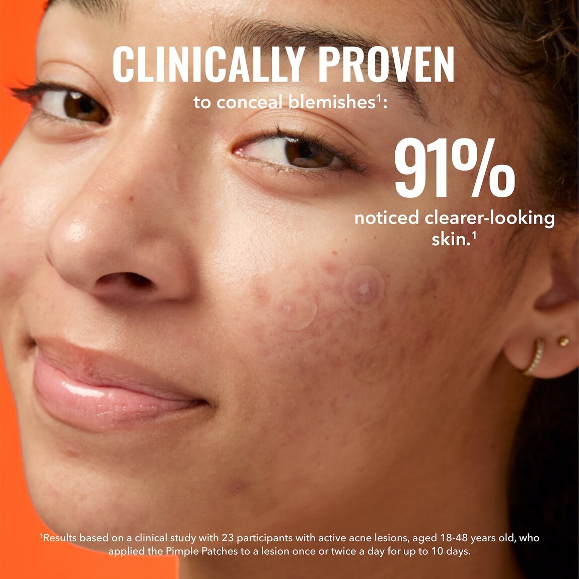 pimple-patches-l4 zb_p.jpg