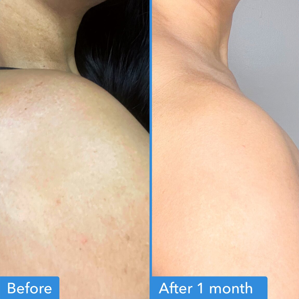 discoloration-correcting-body-treatment-f6 zb_p.jpg