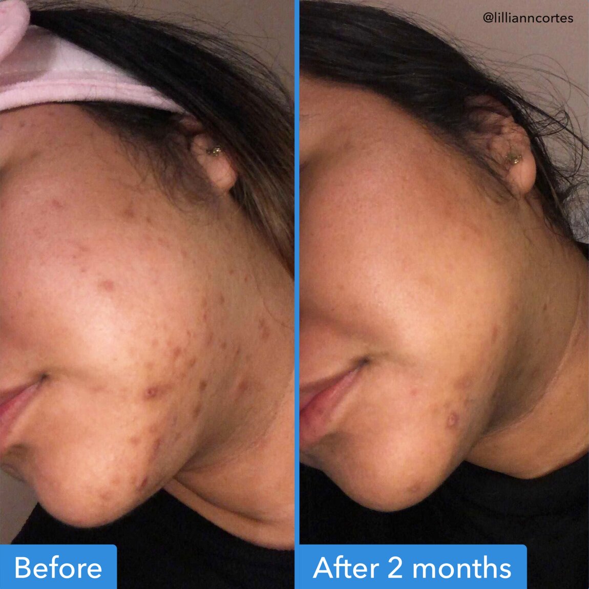 discoloration-correcting-serum-z0 zb_p.jpg